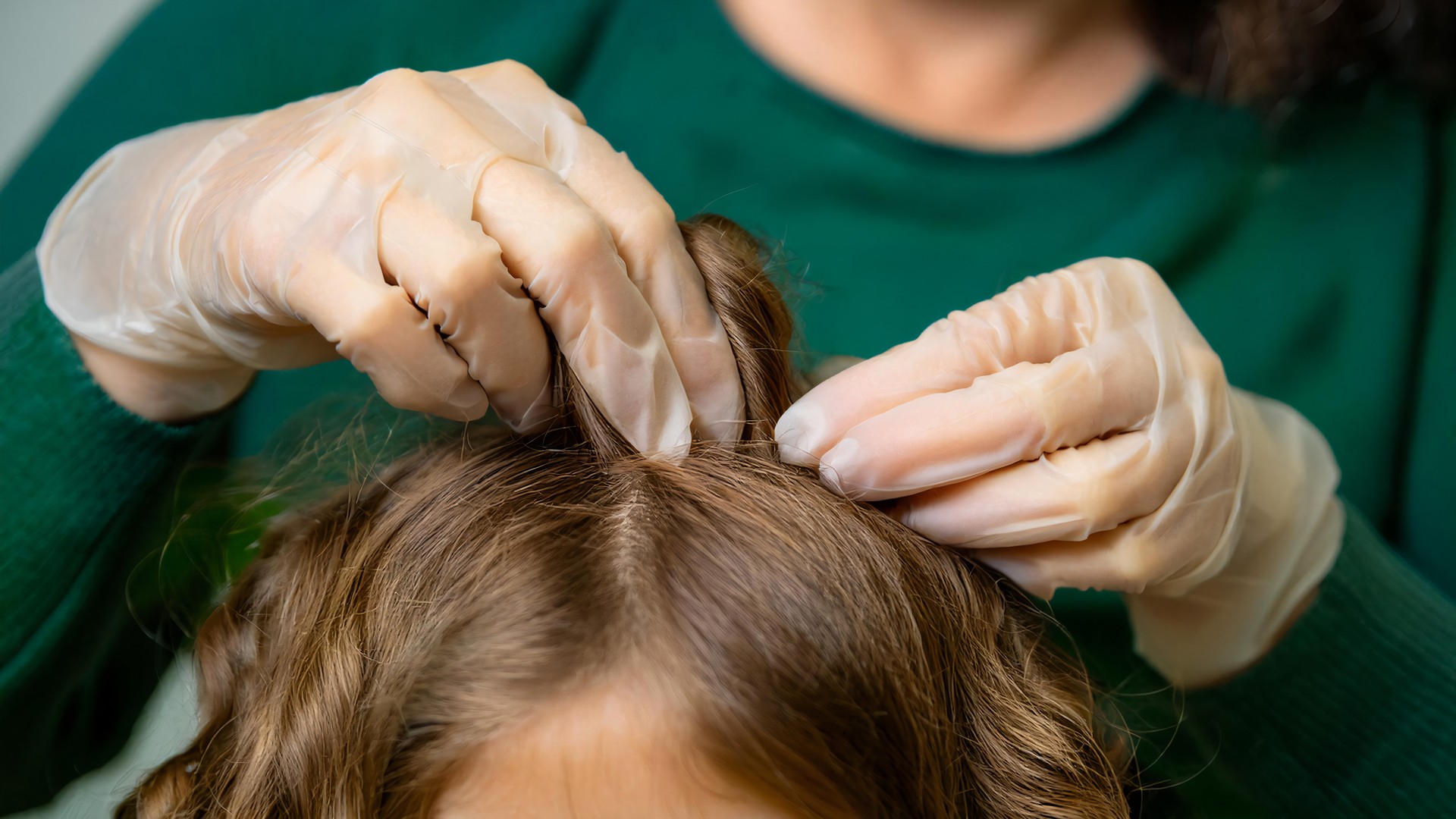 Can Lice Live on Hairbrushes, Headbands, and Clips?