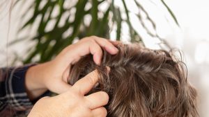A parent's hands carefully parting a school-aged child's hair to search for head lice after a summer camp pickup, with the focus on the nape of the neck where post-camp checks usually start.