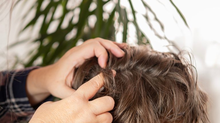 When to Check Kids for Lice After Summer Camp