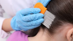Can a Hair Dryer Actually Kill Head Lice?