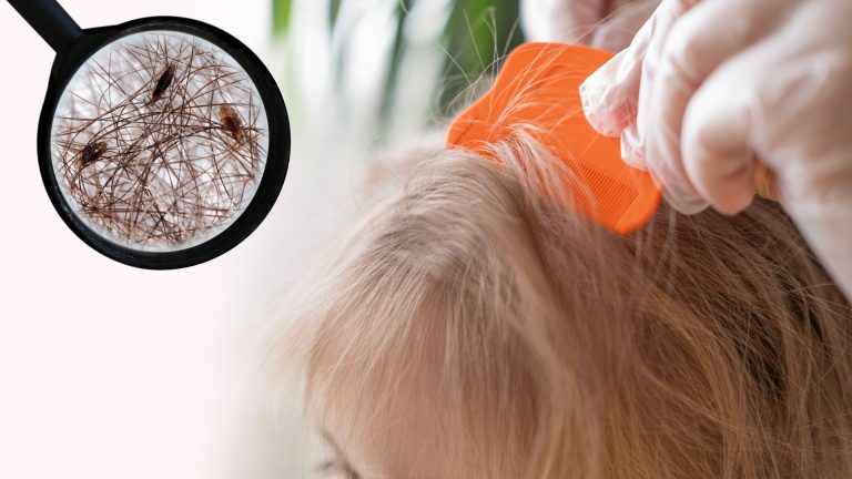 Drugstore Lice Kit or a Pro: What It Really Costs