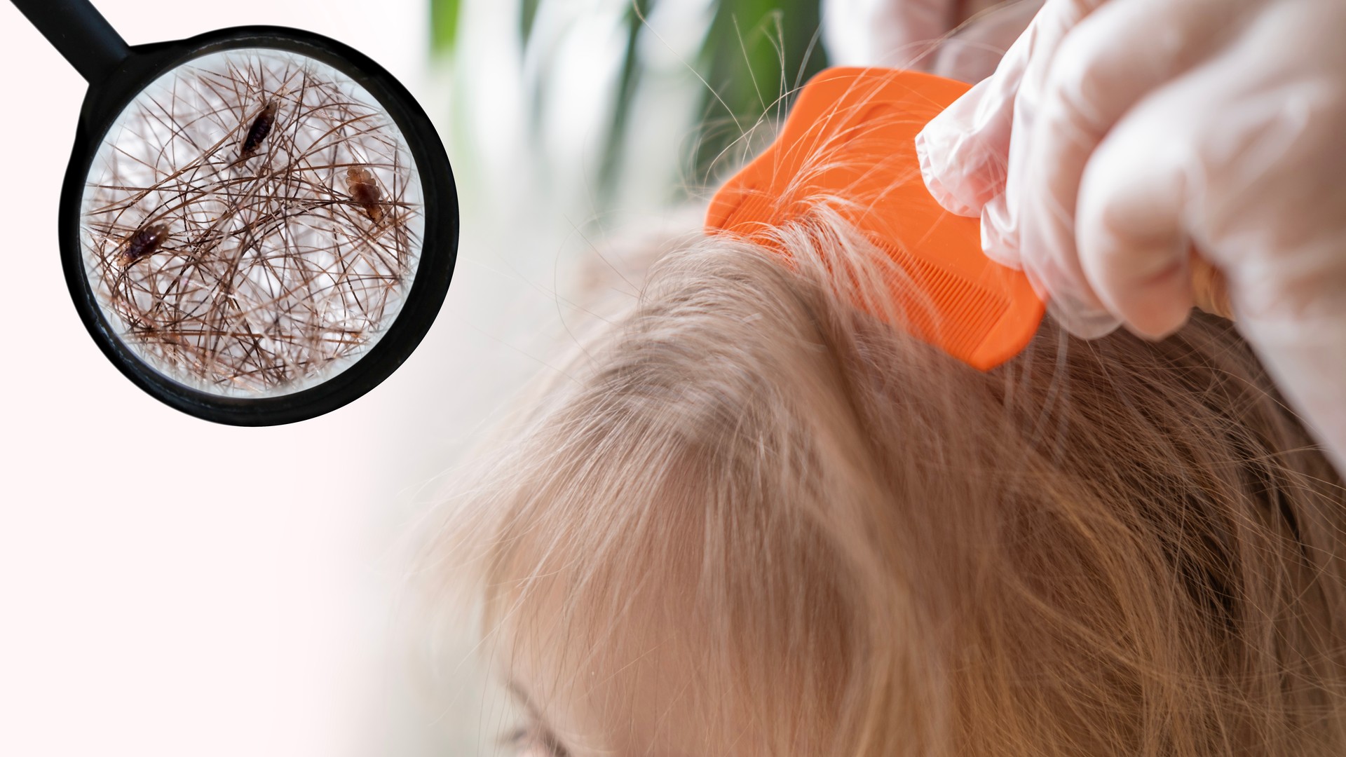 Drugstore Lice Kit or a Pro: What It Really Costs