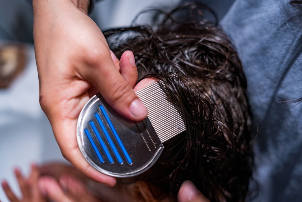 How Long Does It Take to Get Rid of Lice?