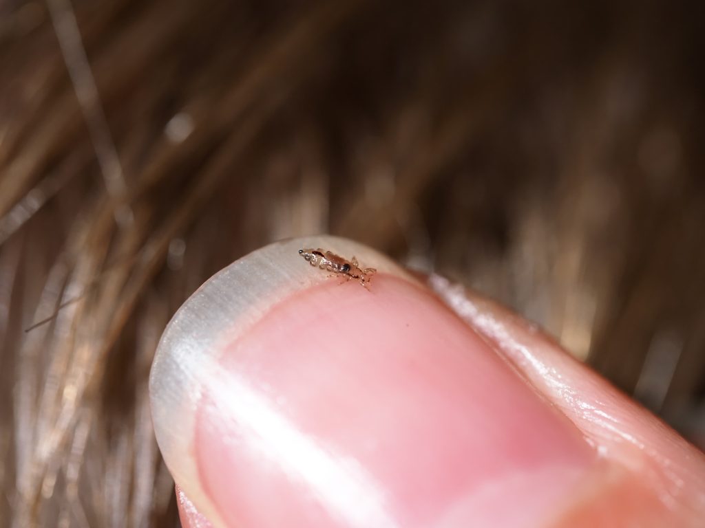 Most Effective Lice Treatment Options Compared