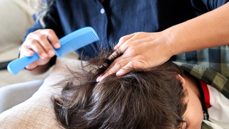 Permanent Lice Removal Isn’t a Product, It’s a Process