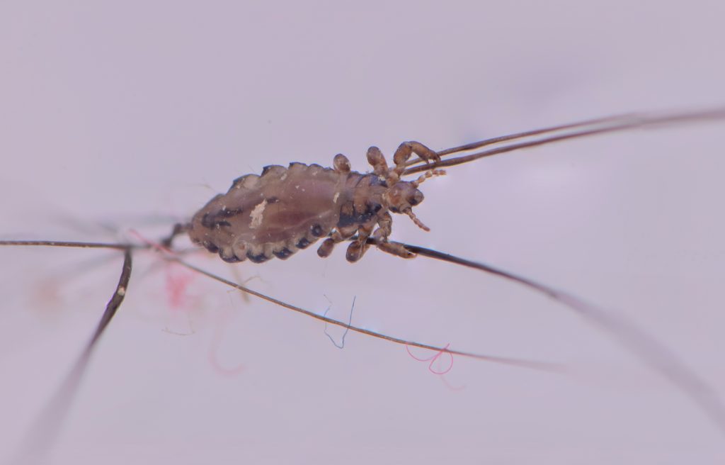 Understanding the Head Louse