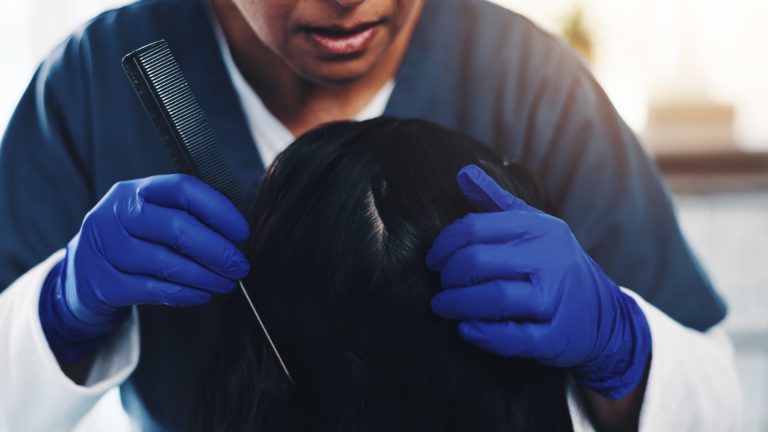 What a Professional Lice Check Catches That a Home Look Misses