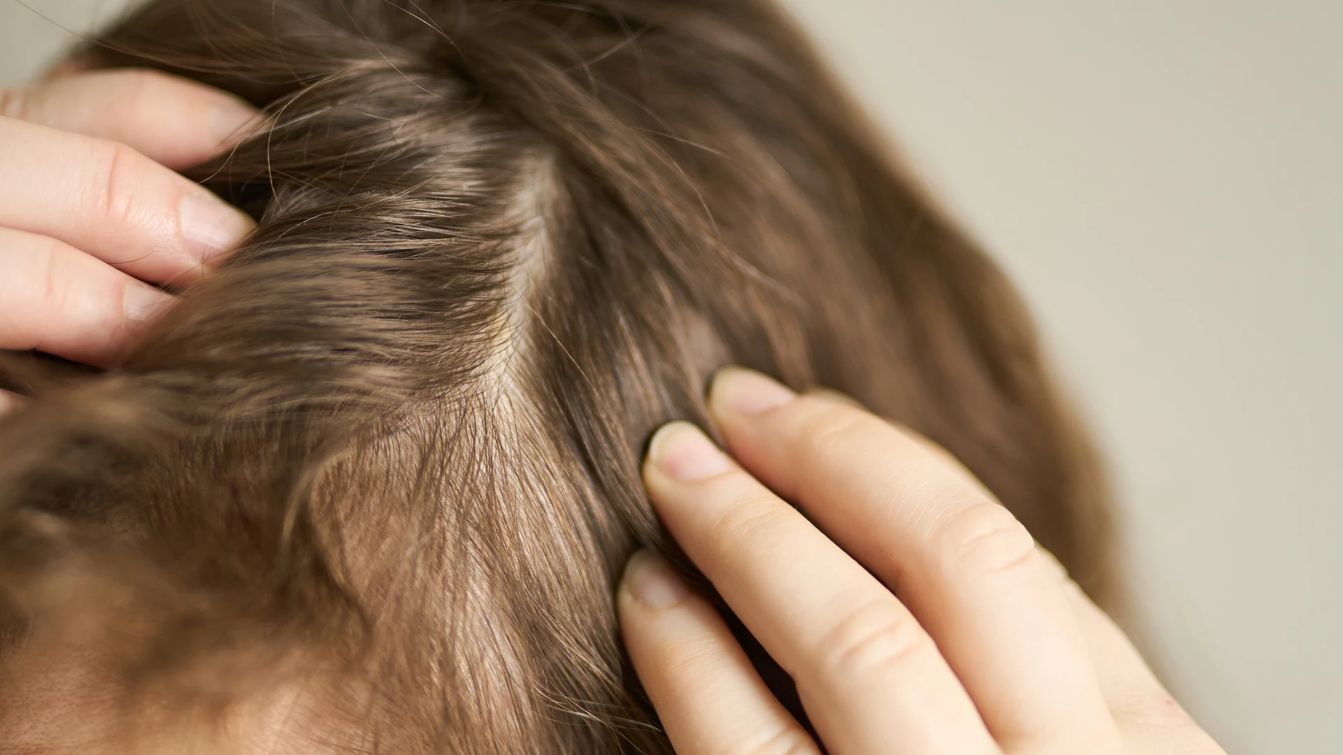 Hands parting brown hair to check along the part and scalp