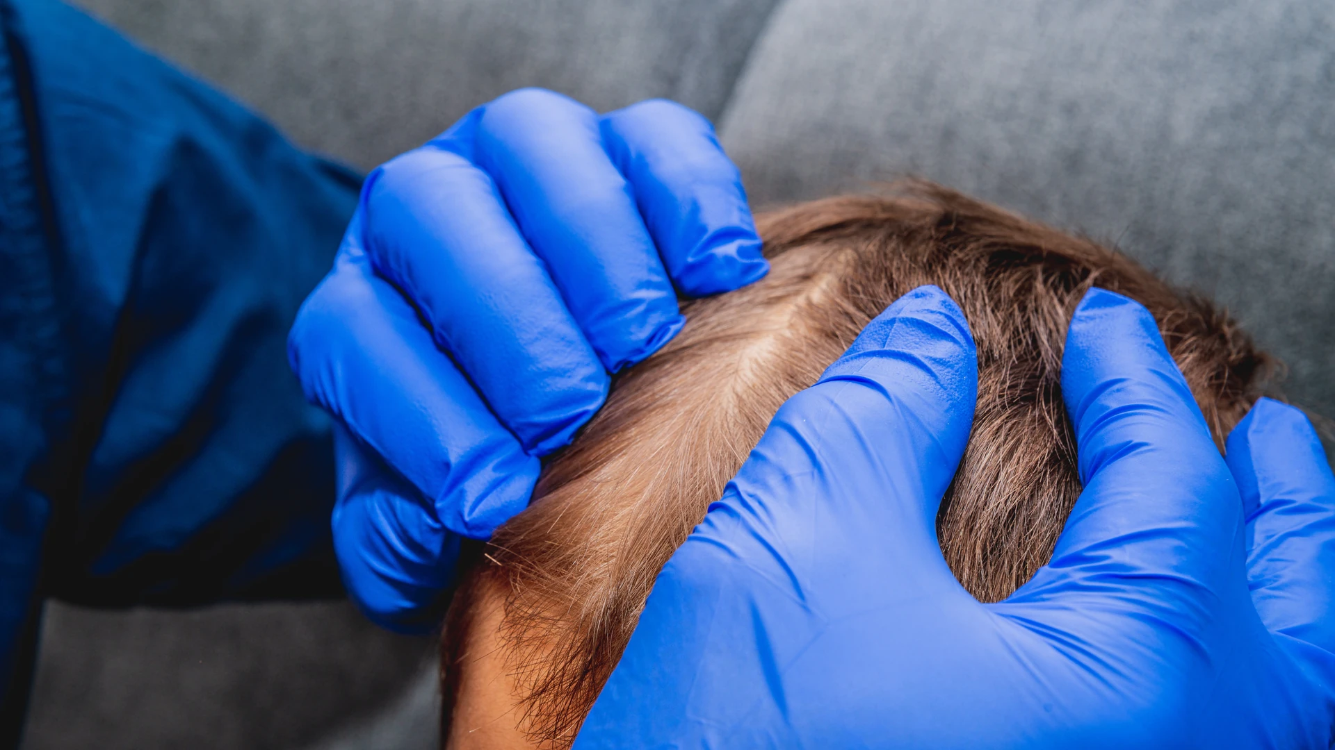 Blue-gloved hands parting brown hair to inspect the scalp.